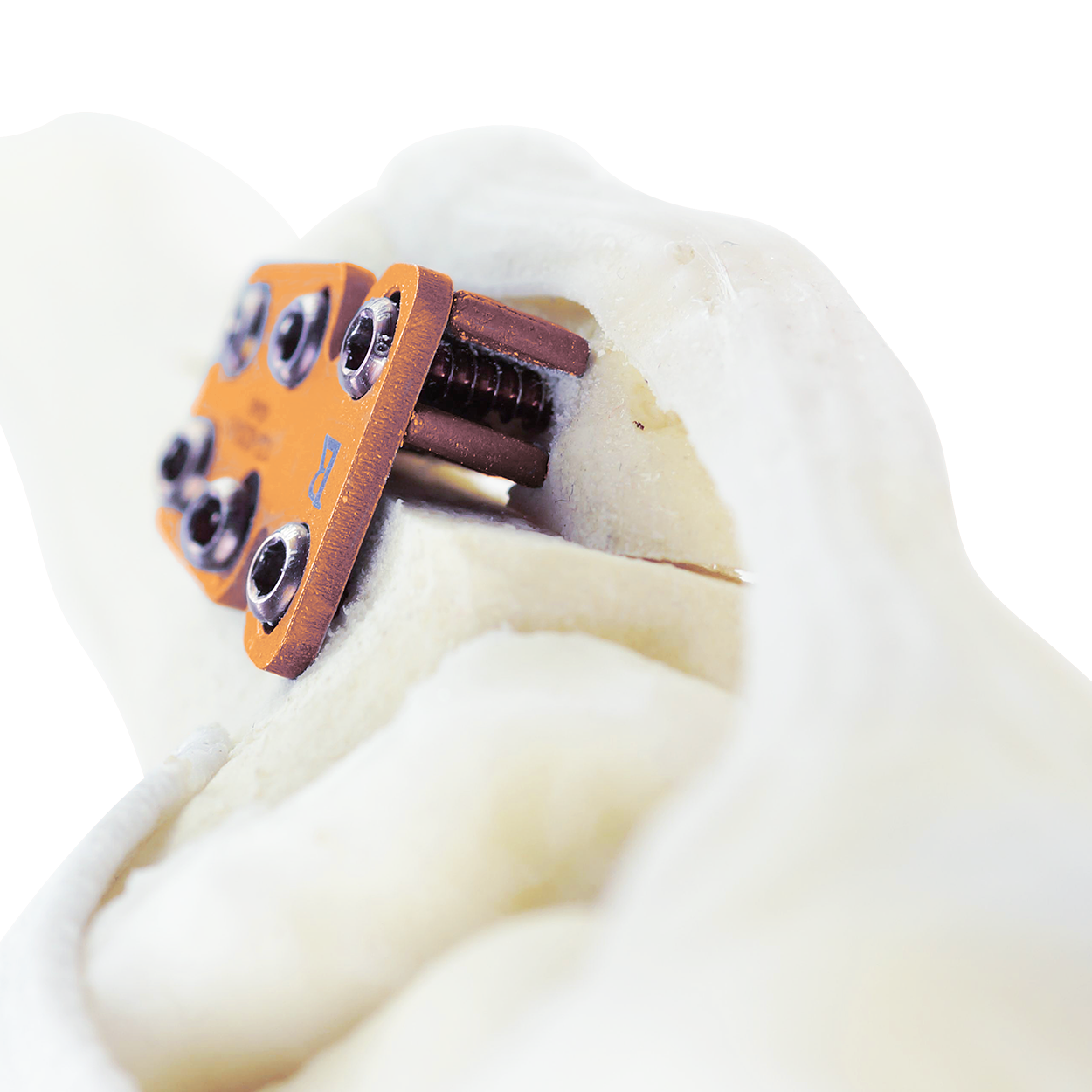 132-8200-01_Sawbone3__0.5x_PNG