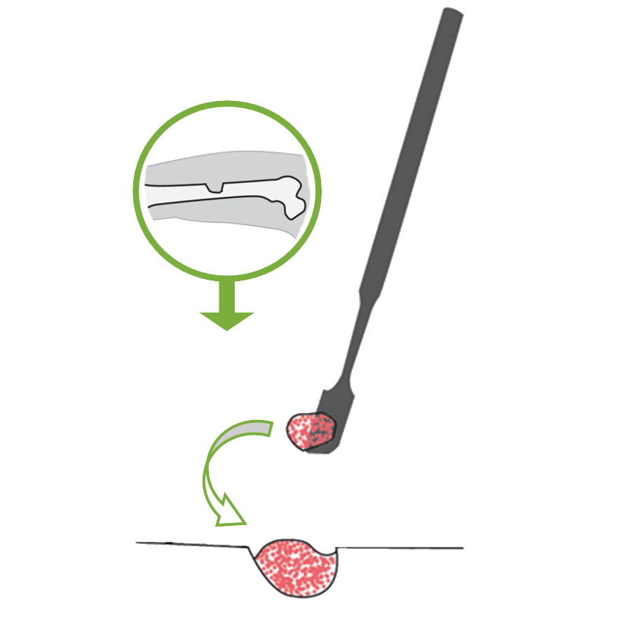 Bone Matter_Application_1