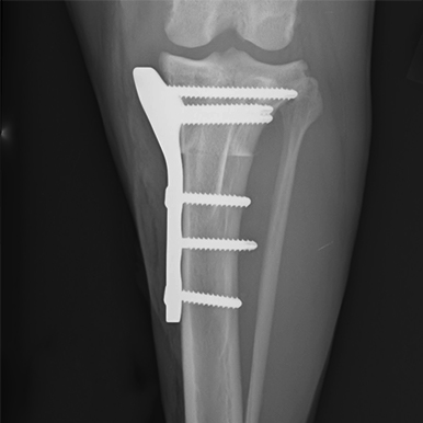 TPLO X-Ray_Serie1002_Bild1002_sq_sm