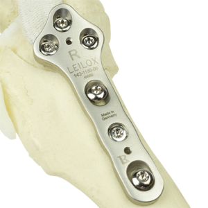 142-1135-00_Rev2_1_WEB