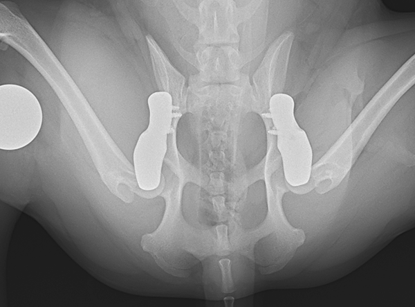 3 - 3D HIP Surgery Iba Shinu