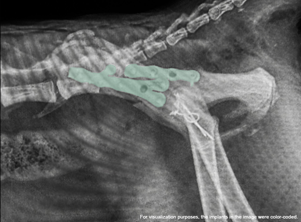 Matan Or_Cat with comminuted Illium and Acetabulum Fracture_4_new