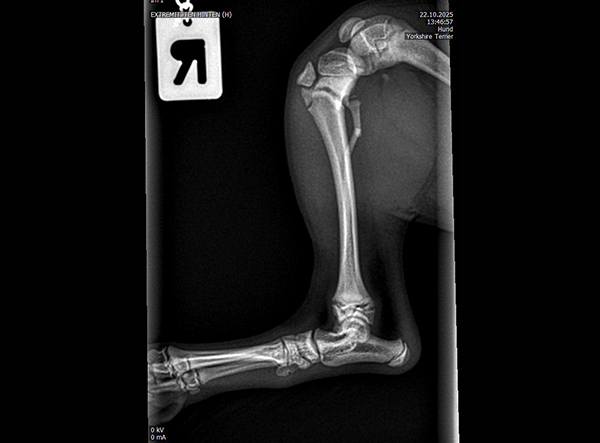 1 - Dr. Weber - 1.5mm RL-TPLO Platte