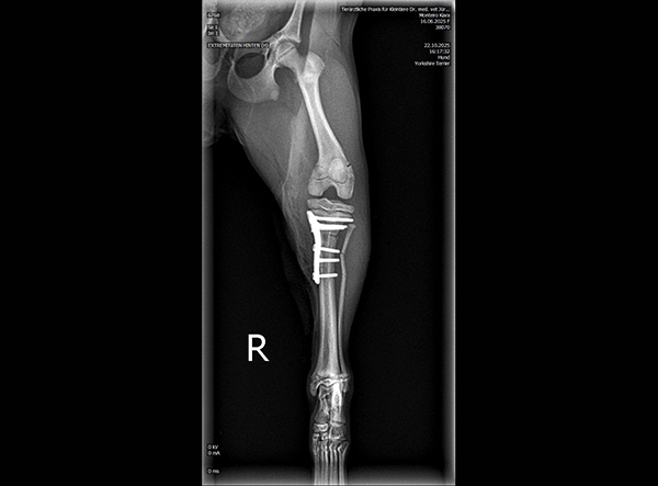6 - Dr. Weber - 1.5mm RL-TPLO Platte Kopie