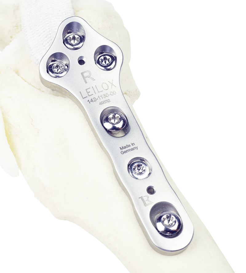 142-1135-00_Rev2_1_smaller