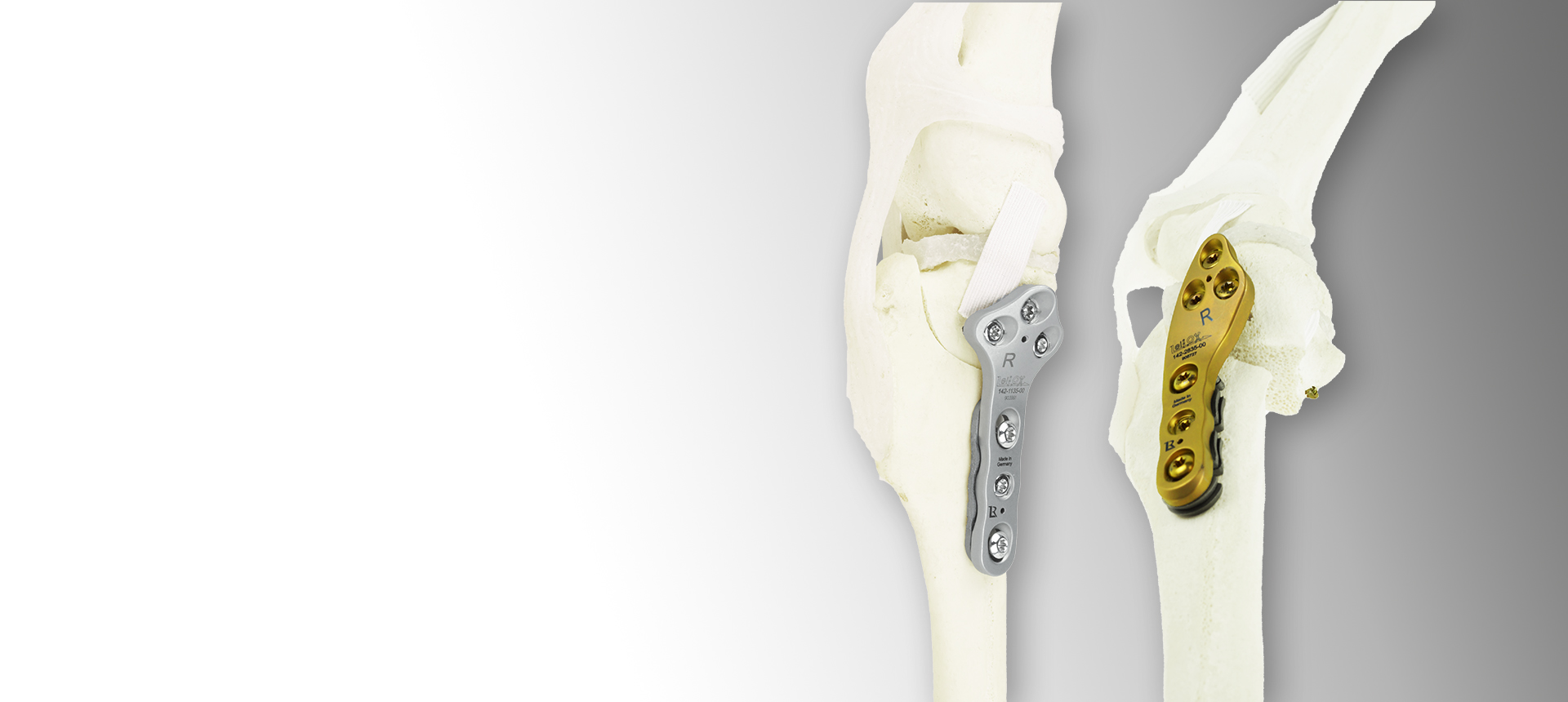 TPLO Patella Luxation Spacer TPLO Patella Luxation Spacers