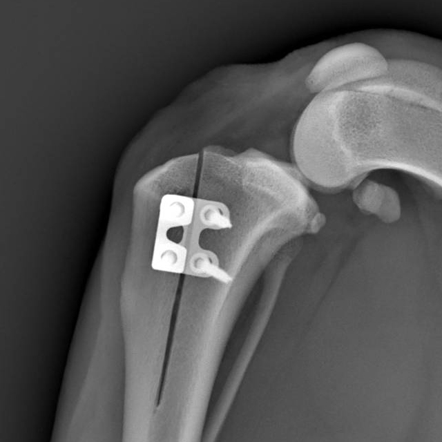 Rapid Luxation_Dr.Petagna_4