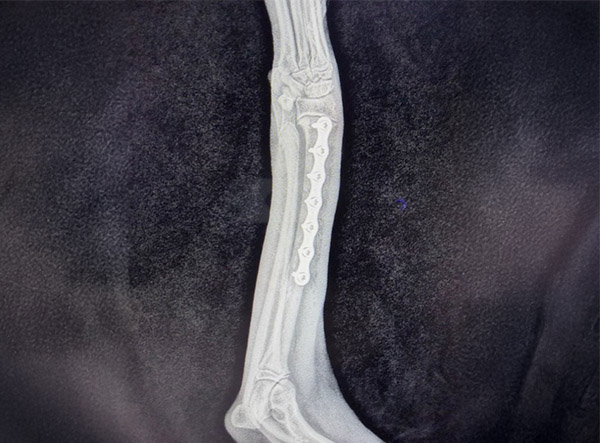 8 - Fracture Case LeiLOX 2.0 mm Titanium Locking Plate - Dr. Jeff Mayo